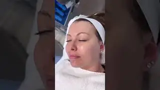 The CO2Lift Pro mask speeds healing and boosts oxygen in the skin. A perfect at-home facial!