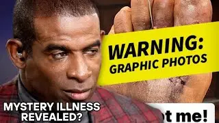 Deion Sanders health update Coach Prime targeting return from mystery  that has hampered Colorado