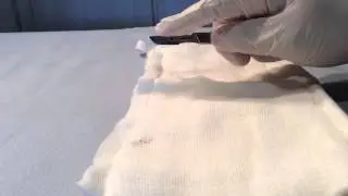 Scalpel Hand Grips