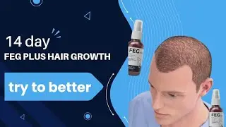 feg plus hair growth spray#hair#shorts #minivlog
