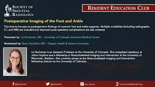 SSR Resident Education Club - Postoperative Imaging of the Foot and Ankle