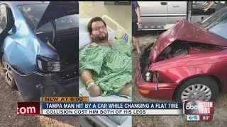 Tampa man changing tire, hit by car, loses legs