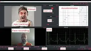 StreamLab : cutting-edge software combining eye tracking videos and physiological data for research
