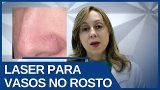 LASER para vasos no rosto