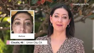Real customers. Real stories. Real results. | Musely Dark Spot Remover Reviews