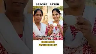 3 skin whitening soaps 240rs only, 9866234836 whatsapp to buy #whiteningsoap #beautysoap