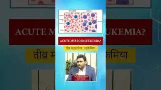 Acute Myeloid Leukemia Risk Stratification #acutemyeloidleukemia #bloodcancer #cancer #drkarunakumar
