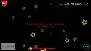 Exercises following Fracture of Humerus (Upper arm)