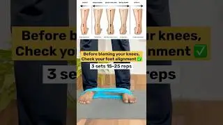Knee Pain Ka Asli Reason? Check Your Foot Alignment
