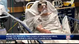Maine woman describes devastating effects of rare tick-borne Powassan virus