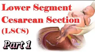 LSCS Instruments & Their Purposes 🛠️🔍 | Essential Tools for Lower Segment C-Section!