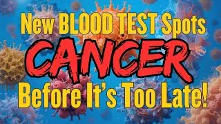 LATEST NEWS: Blood Test for early cancer detection!