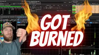 ANVS.. Just got burned - Day Trade Recap