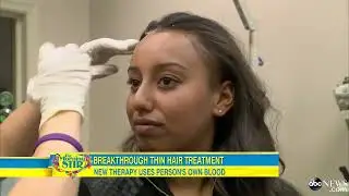 Platelet Rich Plasma (PRP) - How to Grow Hair Fast | Rejuvenus Clinic | Toronto