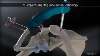 AC Repair Using Dog Bone&trade; Button Technology
