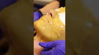 Microdermabrasion Services at  Purlux Salon Montreal