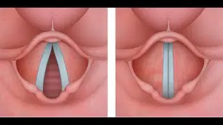 Throat Anatomy in 3D &mdash; The Journey of Air and Sound