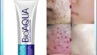Bioaqua acne cream review | how to use complete method | beauty addiction official