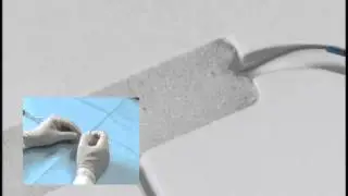 Angioplasty technique: CTO lesion