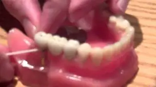 Correct way to floss a dental implant by Periodontal Associates