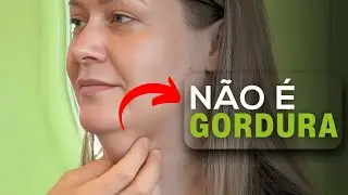 FLACIDEZ no PESCOÇO: Como ELIMINAR? | Última cirurgia do ANO | Caso THAIS