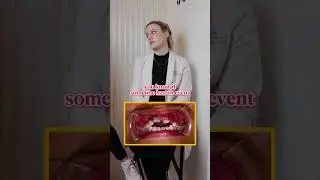 What is considered a &lsquo;Dental Emergency&rsquo;? 🦷🚨 #trulydental #dentist #qanda #dental  #emergency