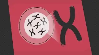 Acute myeloid leukemia: Chromosomal changes