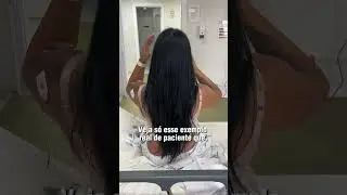 Sim, &eacute; poss&iacute;vel ter uma recupera&ccedil;&atilde;o suave e &aacute;gil com a t&eacute;cnica R24R.