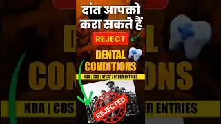 ऐसे होता है NDA में दांतों का मेडिकल | पूरी जानकारी | Know About Your Dental Points #nda #shorts