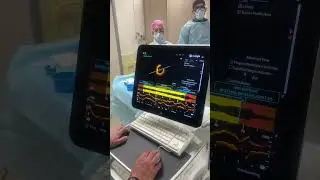 Оптический томограф в 