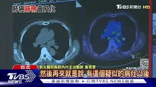 普篩？ 風險預測？ 沉默殺手「肺癌」你不可不知｜十點不一樣 20210108