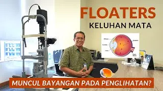 Kenali Floaters! Bercak Bayangan Pada Mata