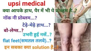 upsi medical update | medical के लिये महत्वपूर्ण जानकारी | यदि यह problem है तो दूर कर लो