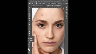 using Spot Healing Brush tool to remove pimples#shorts #youtubeshorts #photoshop #shortviral