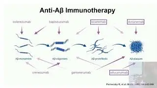 An overview on emerging disease-modifying therapies in Alzheimer’s Disease by Dr. Seán O’Dowd