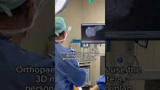 Robot-assisted joint replacement surgery