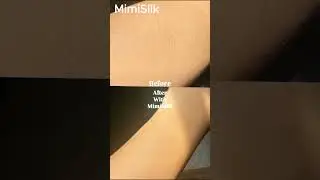 Before and After with MimiSilk