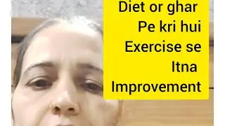 Diet Or ghar pe kari exercise se Severe autism me bhi itna improvement hua h aap soch bhi nhi sakte 
