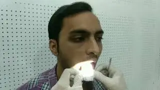Throat Examination- Examination of Larynx and Laryngopharynx - Dr Mohan Bansal