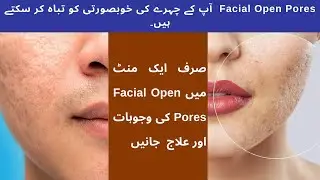 1 Minute details of Open Pores skin problem.
