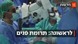 היסטוריה: אישה שעברה המתת חסד תרמה את פניה לאישה אחרת