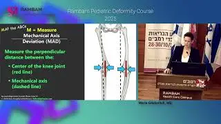 Rambam Pediatric Limb Deformity Course 2025 - Marie Gdalevitch, M (L 2)