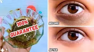 Best DIY Eye Mask for Puffy Eyes & Dark Circles | Fast & Natural Remedy