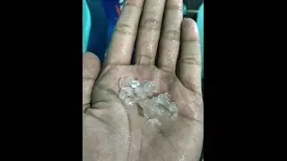 hujan es bandung