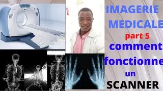 IMAGERIE MÉDICALE part5: Comment fonctionne un scanner/ How a scanner works
