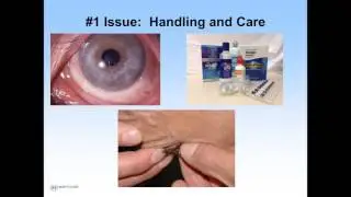 An Ounce of Prevention, A Pound of Cure: Avoiding / Managing Complications of Scleral Lenses
