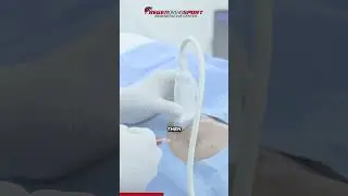 What Are The Most COMMON Orthopedics Injuries? | Dr. Movva - RegenOrthoSport