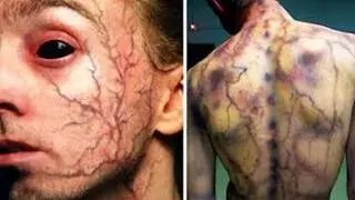 Top 10 Medical Cases Doctors Couldn&rsquo;t Explain