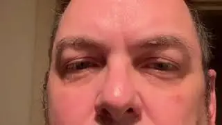 Shaklee Youth Eye Treatment 2/2