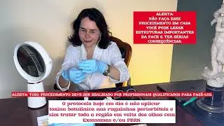 Exossomas e PDRN: protocolo para tratamento de rugas e olheiras #Exossomas #pdrn #rejuvenescimento 